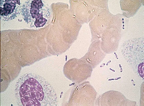 Microscoopbeeld van de pestbacterie Yersinia pestis (Wayson-kleuring).